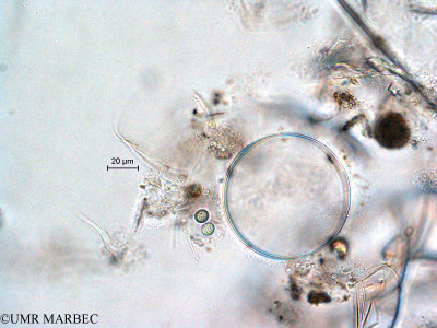 phyto/Scattered_Islands/all/COMMA April 2011/Chroococcus turgidus (ancien sp8 )(copy)_thumb.jpg